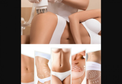 CBL-514: революционный препарат для коррекции фигуры и лечения ожирения без операции